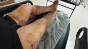 KÜÇÜK KIZI KÖPEKTEN KURTARMAYA  ÇALIŞIRKEN KENDİ SALDIRIYA UĞRADI
